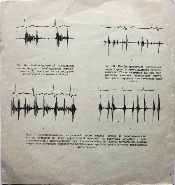 Малая медицинская энциклопедия (аудиоприложение). Пластинка 14